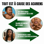 Charger l'image dans la galerie, Spray Insecticide Anti-Acariens – Dormez Enfin Serein