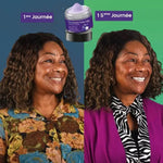 Charger l'image dans la galerie, HZA Teeth – Traitement professionnel de blanchiment dentaire
